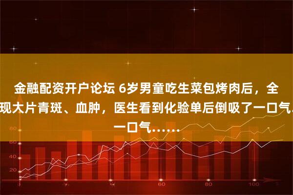 金融配资开户论坛 6岁男童吃生菜包烤肉后，全身出现大片青斑、血肿，医生看到化验单后倒吸了一口气……